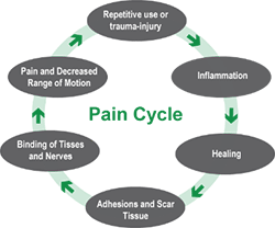 pain cycle diagram