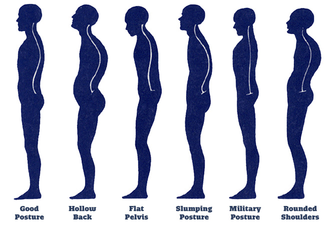 Six Ways to Improve Your Posture – Wellness Focus